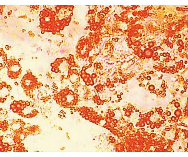 Himedia HiDiff Adipogenesis Assay Kit