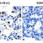 Merck Anti-SARS-CoV-2 (COVID-19) Envelope ant&