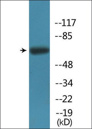 Merck Anti-phospho-Fyn (pTyr530) antibody produced in rabbit