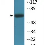 Merck Anti-phospho-Fyn (pTyr530) antibody produced in rabbit