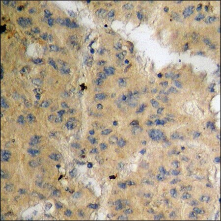 Merck Anti-phospho-LIMK1 (pThr508) antibody produced in rabbit