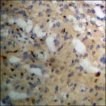 Merck Anti-phospho-PKC alpha (pTyr658) antibody produced in rabbit