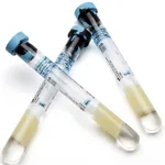 BD Vacutainer® CPT™ Mononuclear Cell Preparation Tube - Sodium Citrate