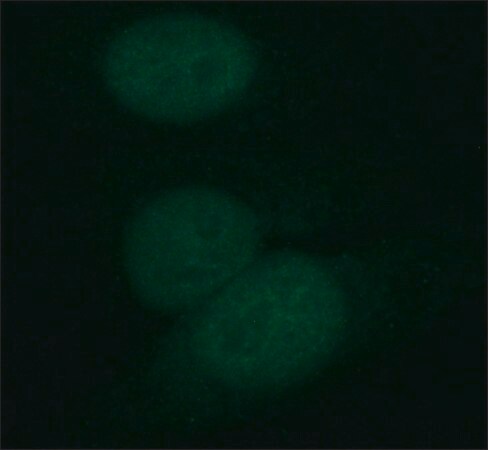 Merck Monoclonal Anti-DHX9/RHA antibody produced in rat