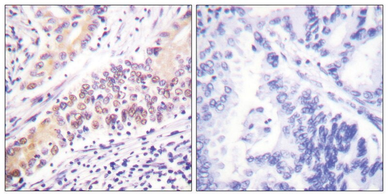 Merck Anti-TOP2B antibody produced in rabbit