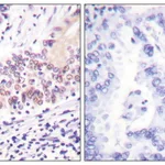 Merck Anti-TOP2B antibody produced in rabbit