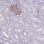 Merck Anti-ROS1 antibody produced in rabbit