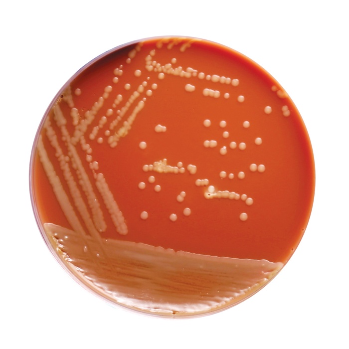 Himedia GC Agar Base