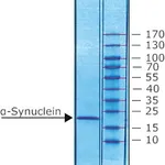 Merck ALPHA-SYNUCLEIN