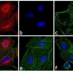 Thermo Fisher Scientific Donkey anti-Rat IgG (H+L) Cross-Adsorbed Secondary Antibody, DyLight 594