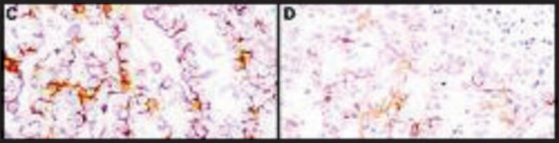 Merck Monoclonal Anti-Mesothelin antibody produced in mouse