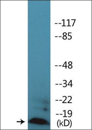 Merck Anti-phospho-Synuclein (pSer129) antibody produced in rabbit