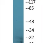 Merck Anti-phospho-Synuclein (pSer129) antibody produced in rabbit