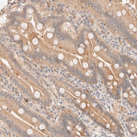 Merck Anti-TNK1 antibody produced in rabbit