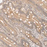 Merck Anti-TNK1 antibody produced in rabbit