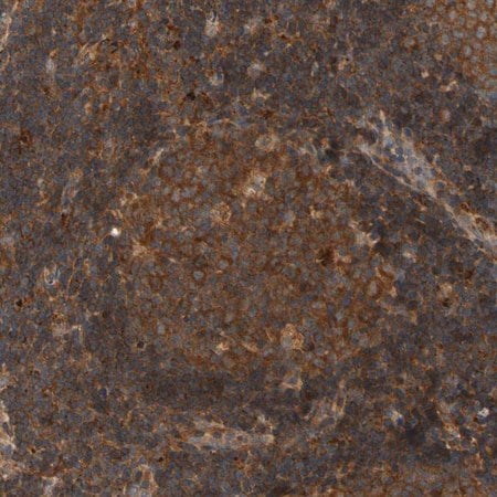Merck Anti-ANKHD1 antibody produced in rabbit