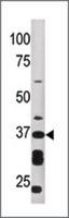 Merck ANTI-ART1 (N-TERM)