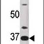 Merck ANTI-ART1 (N-TERM)