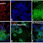 Thermo Fisher Scientific Rabbit anti-Mouse IgG (H+L) Cross-Adsorbed Secondary Antibody, Alexa Fluor 594