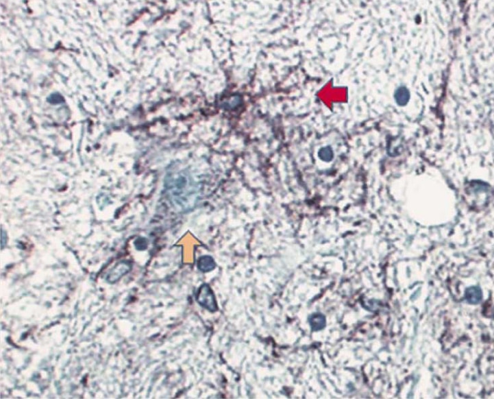 BD Purified Mouse Anti-GFAP