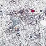 BD Purified Mouse Anti-GFAP