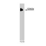 BD Purified Mouse Anti-p120 Catenin