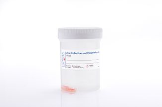 Norgen Urine Collection and Preservation Cup 120 cc