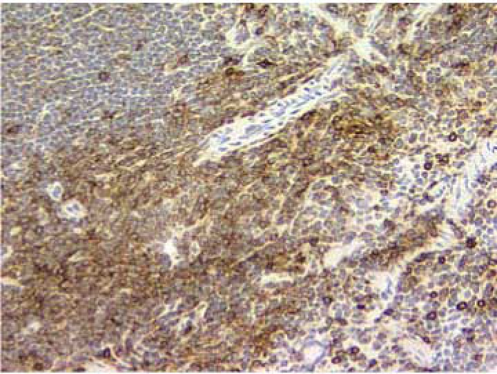 BD Purified Rat Anti-Mouse CD11a