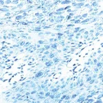 BD Purified Mouse Anti-L1 Protein of Human Papilloma Virus