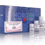 Norgen Plasma/Serum Exosome Purification and RNA Isolation Maxi Kit