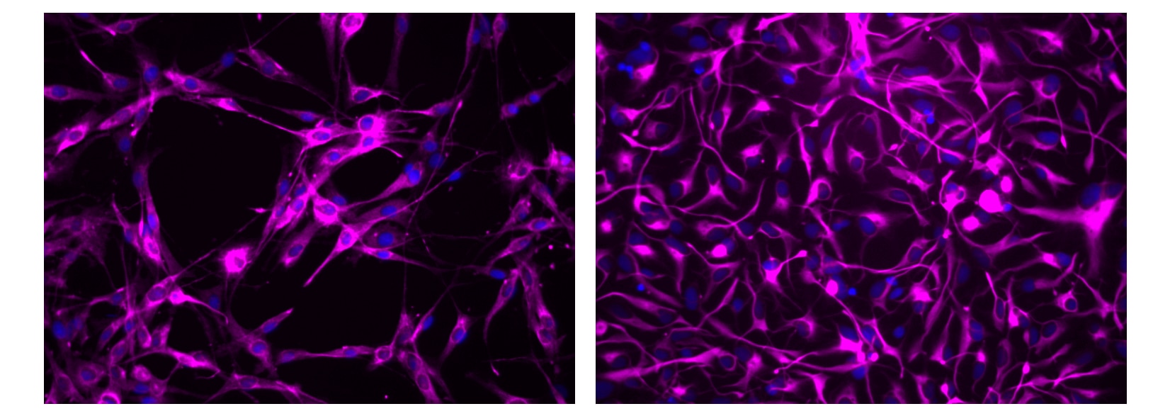 BD Alexa Fluor® 647 Mouse Anti-Nestin