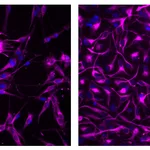 BD Alexa Fluor® 647 Mouse Anti-Nestin