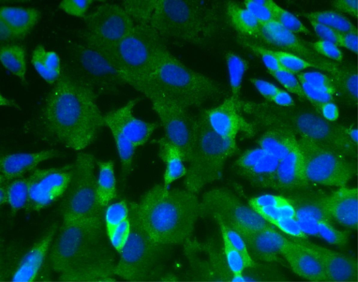 BD Purified Mouse Anti-CaM Kinase II