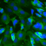 BD Purified Mouse Anti-CaM Kinase II