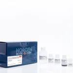 Norgen EXTRAClean Plasma/Serum Exosome Purification and RNA Isolation Mini Kit