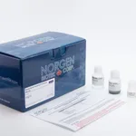 Norgen Plasma/Serum Exosome Purification Mini Kit