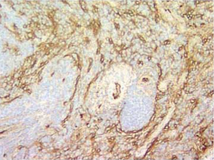 BD Purified Rat Anti-Mouse CD105