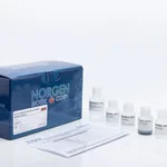 Norgen Urine Exosome Purification and RNA Isolation Midi Kit