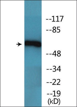 Merck Anti-phospho-Chk2 (pThr68) antibody produced in rabbit