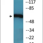 Merck Anti-phospho-Chk2 (pThr68) antibody produced in rabbit
