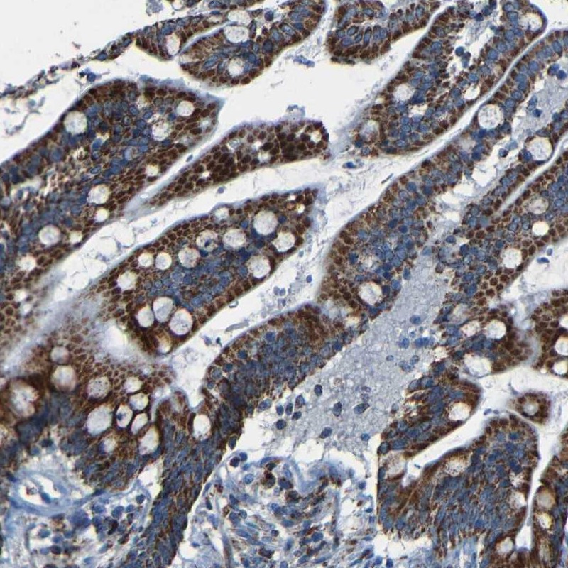 Atlas Antibodies Anti-WSCD2 Antibody