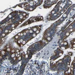 Atlas Antibodies Anti-WSCD2 Antibody