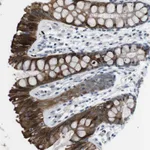 Atlas Antibodies Anti-WSCD1 Antibody