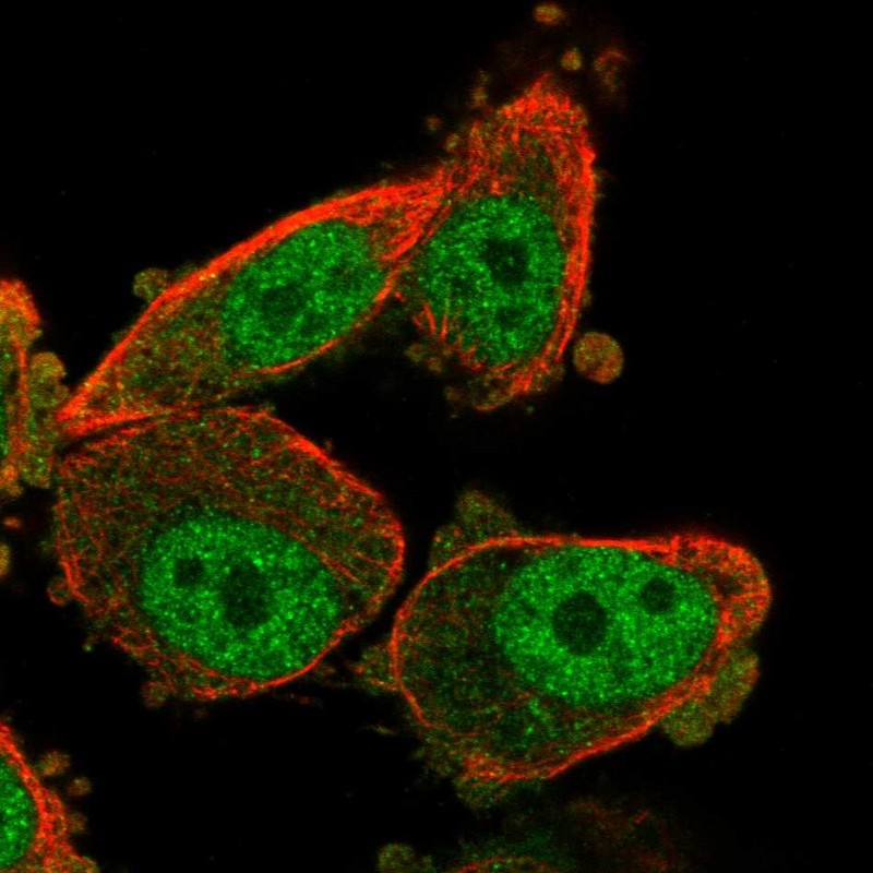 Atlas Antibodies Anti-WT1 Antibody
