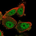 Atlas Antibodies Anti-WT1 Antibody