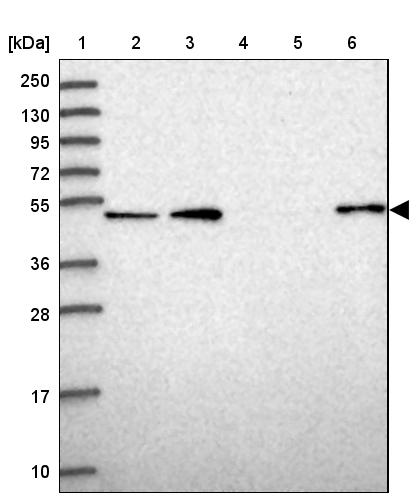 Atlas Antibodies Anti-WSCD2 Antibody