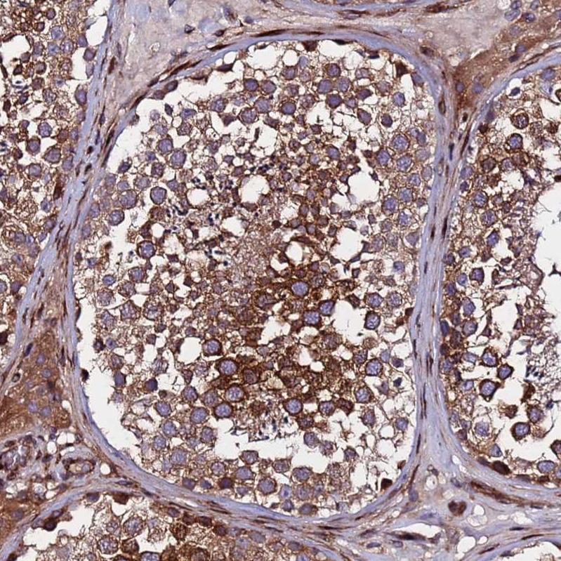 Atlas Antibodies Anti-WWC2 Antibody