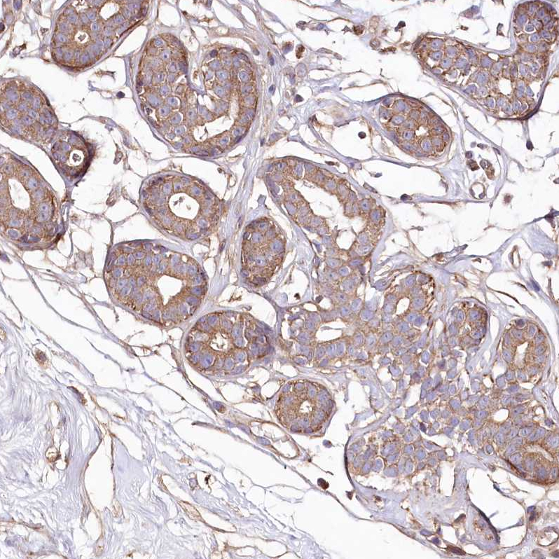 Atlas Antibodies Anti-WWC1 Antibody
