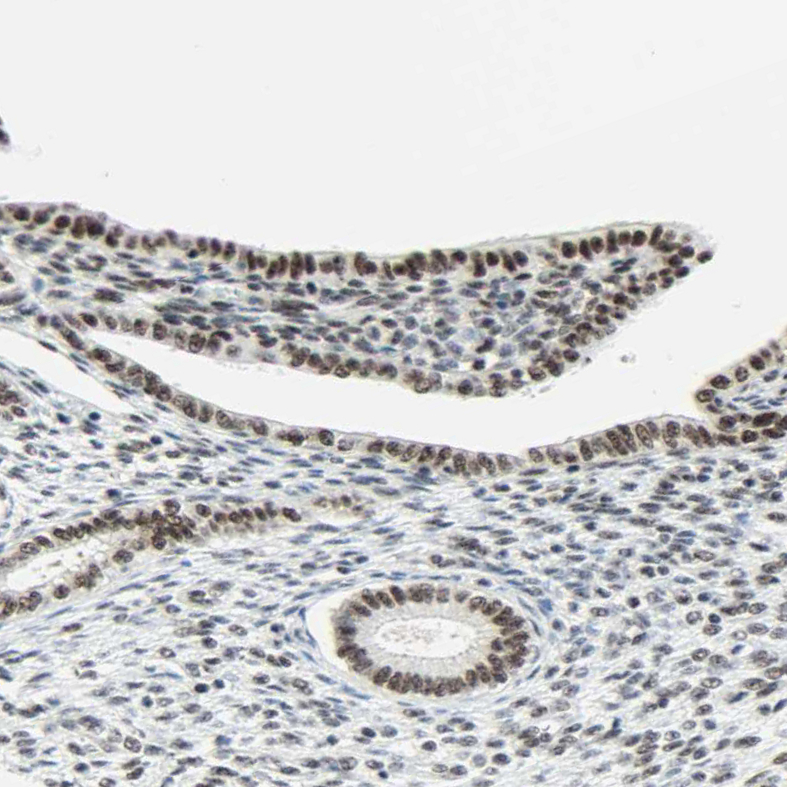Atlas Antibodies Anti-WTAP Antibody