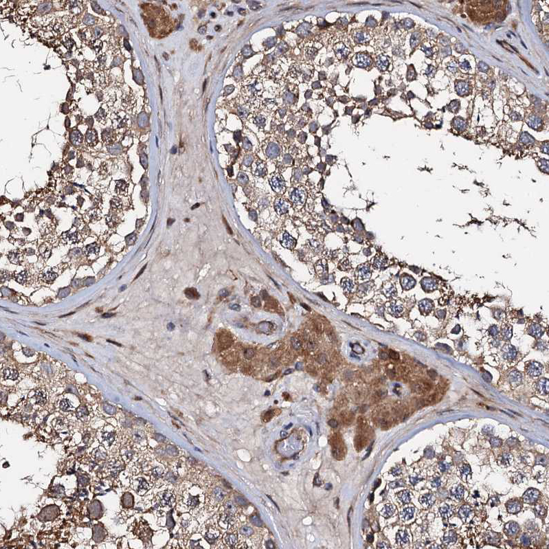 Atlas Antibodies Anti-WWC3 Antibody